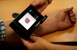 Make skin checks a habit